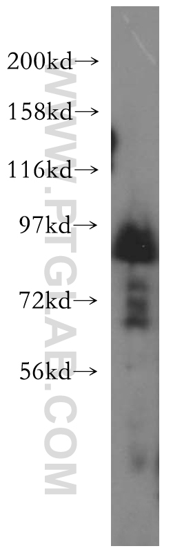 WB analysis of HeLa using 16972-1-AP