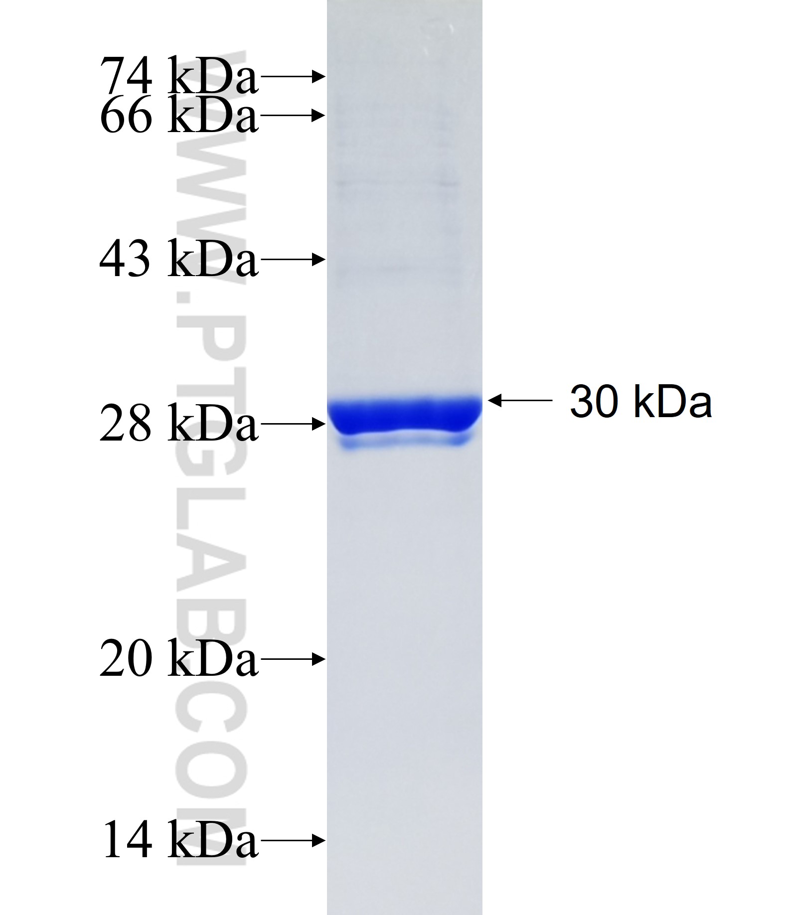 GOLT1B fusion protein Ag34859 SDS-PAGE GOLT1B fusion protein Ag34859 SDS-PAGE