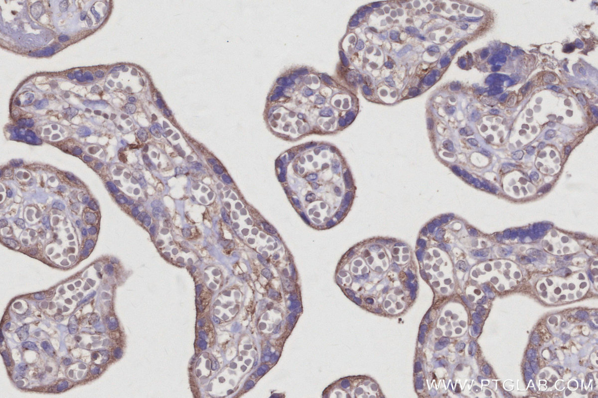 IHC staining of human placenta using 12163-1-AP IHC staining of human placenta using 12163-1-AP
