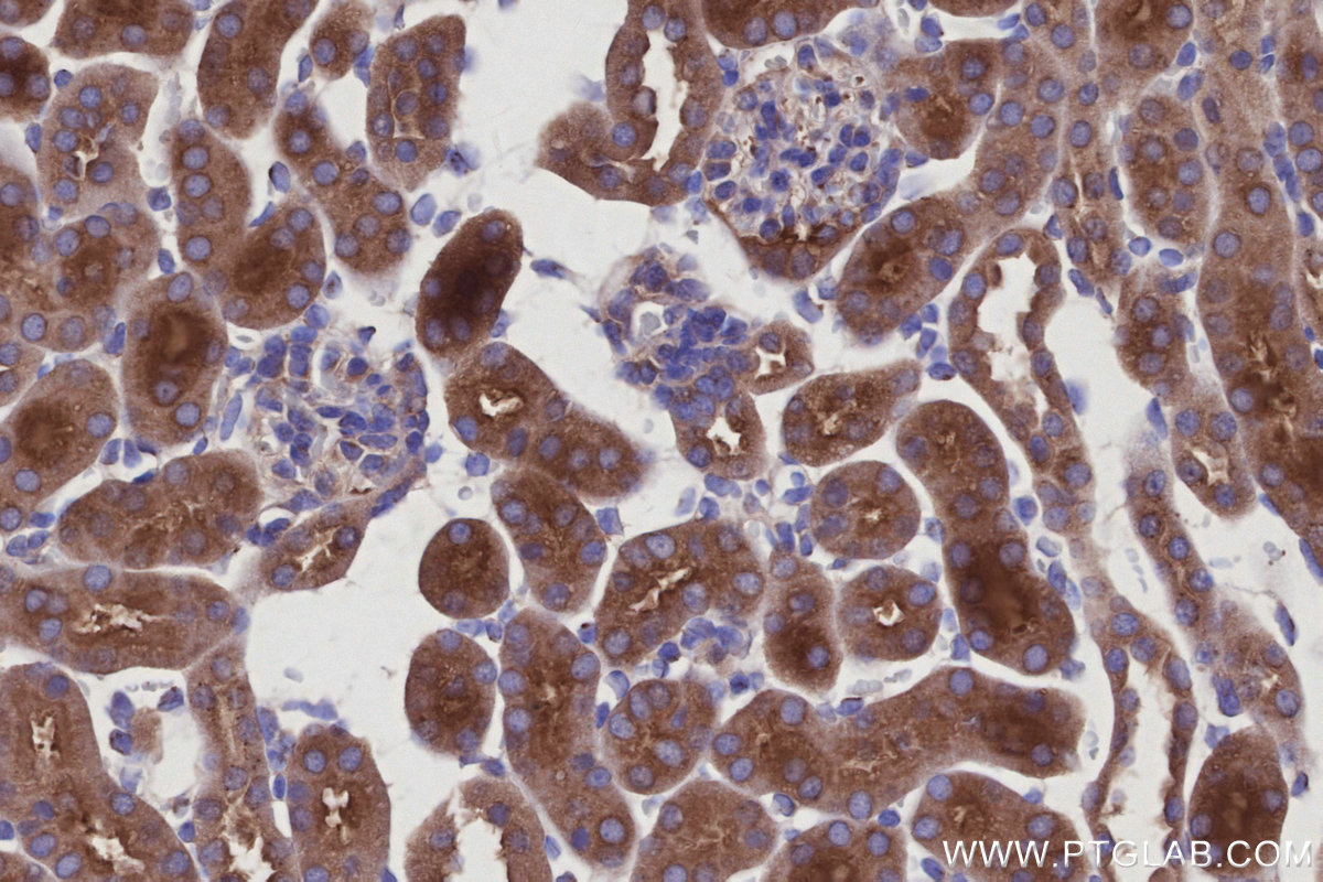 IHC staining of mouse kidney using 12163-1-AP (same clone as 12163-1-PBS) IHC staining of mouse kidney using 12163-1-AP (same clone as 12163-1-PBS)