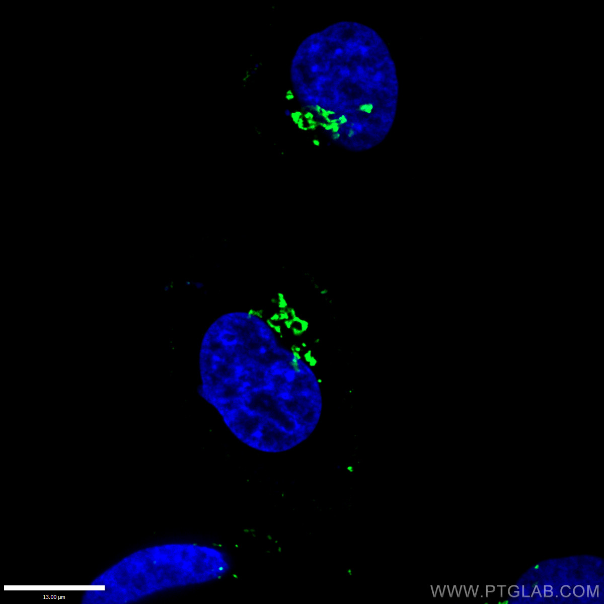 GORASP2 Polyclonal antibody