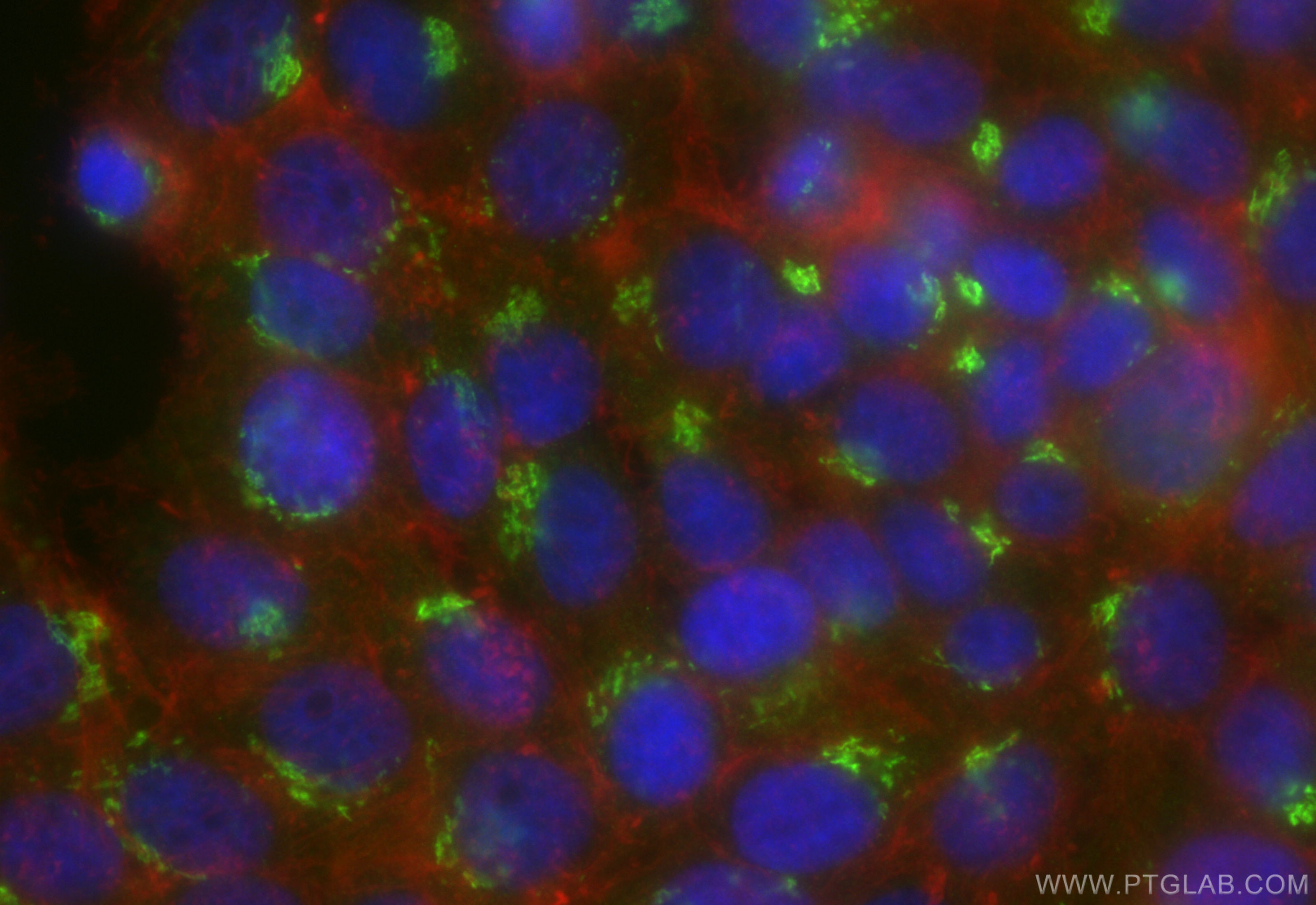 IF Staining of HepG2 using CL488-85077-5