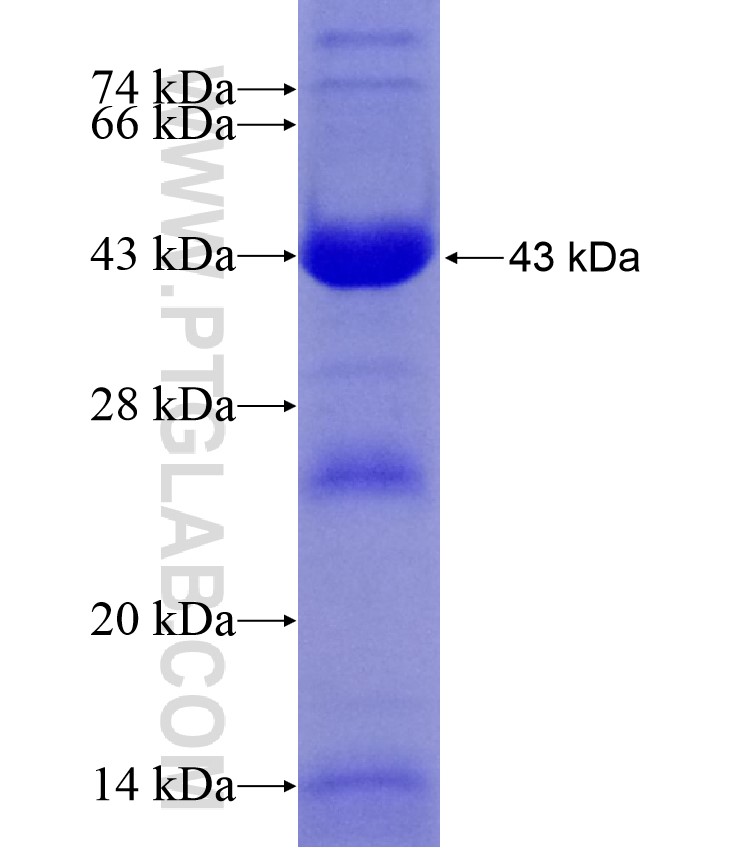 GORASP2 fusion protein Ag17607 SDS-PAGE