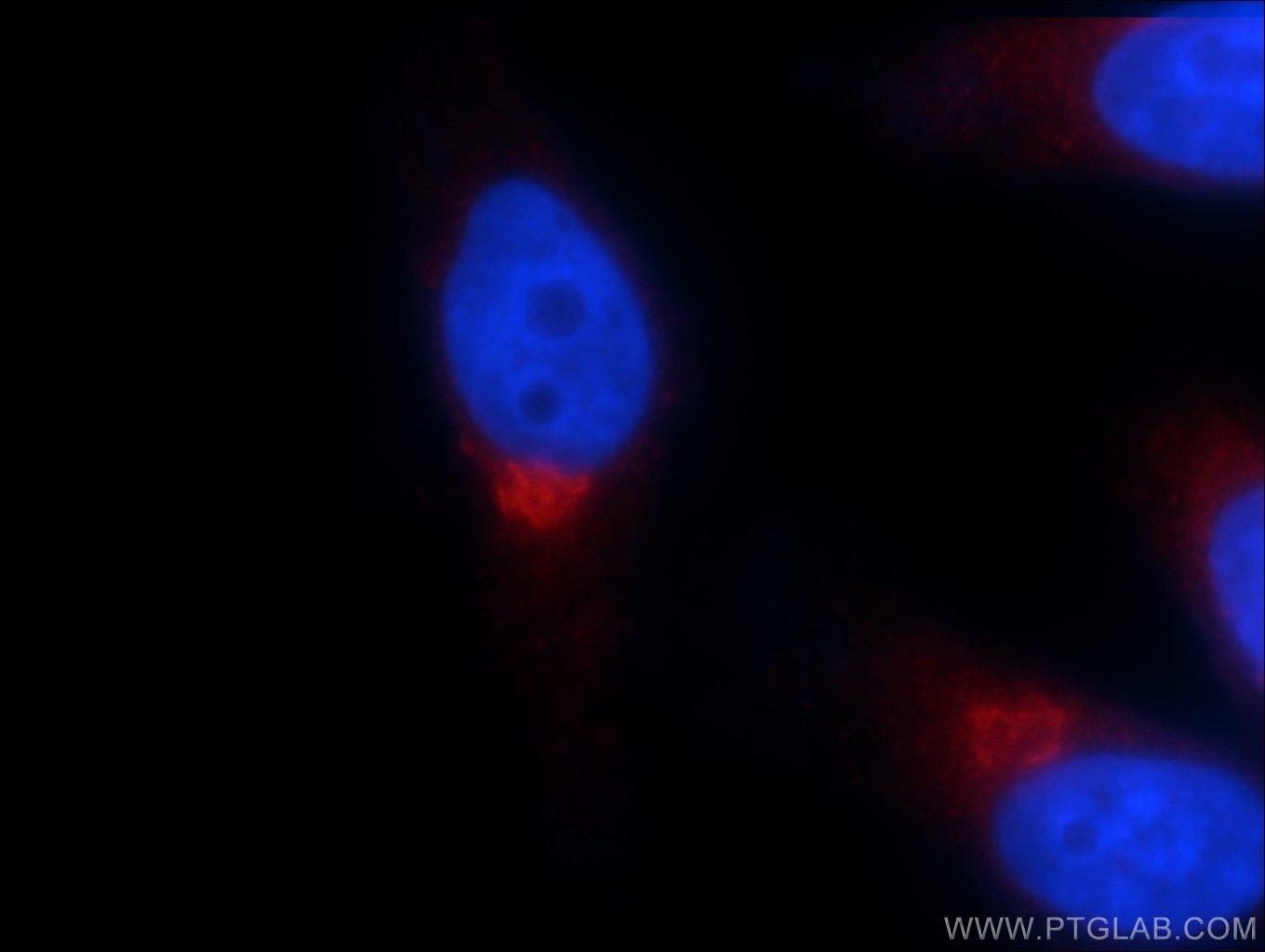 GOSR2/Membrin Polyclonal antibody