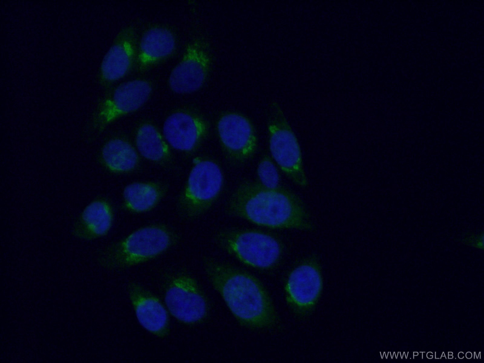 IF Staining of HepG2 using 12095-1-AP