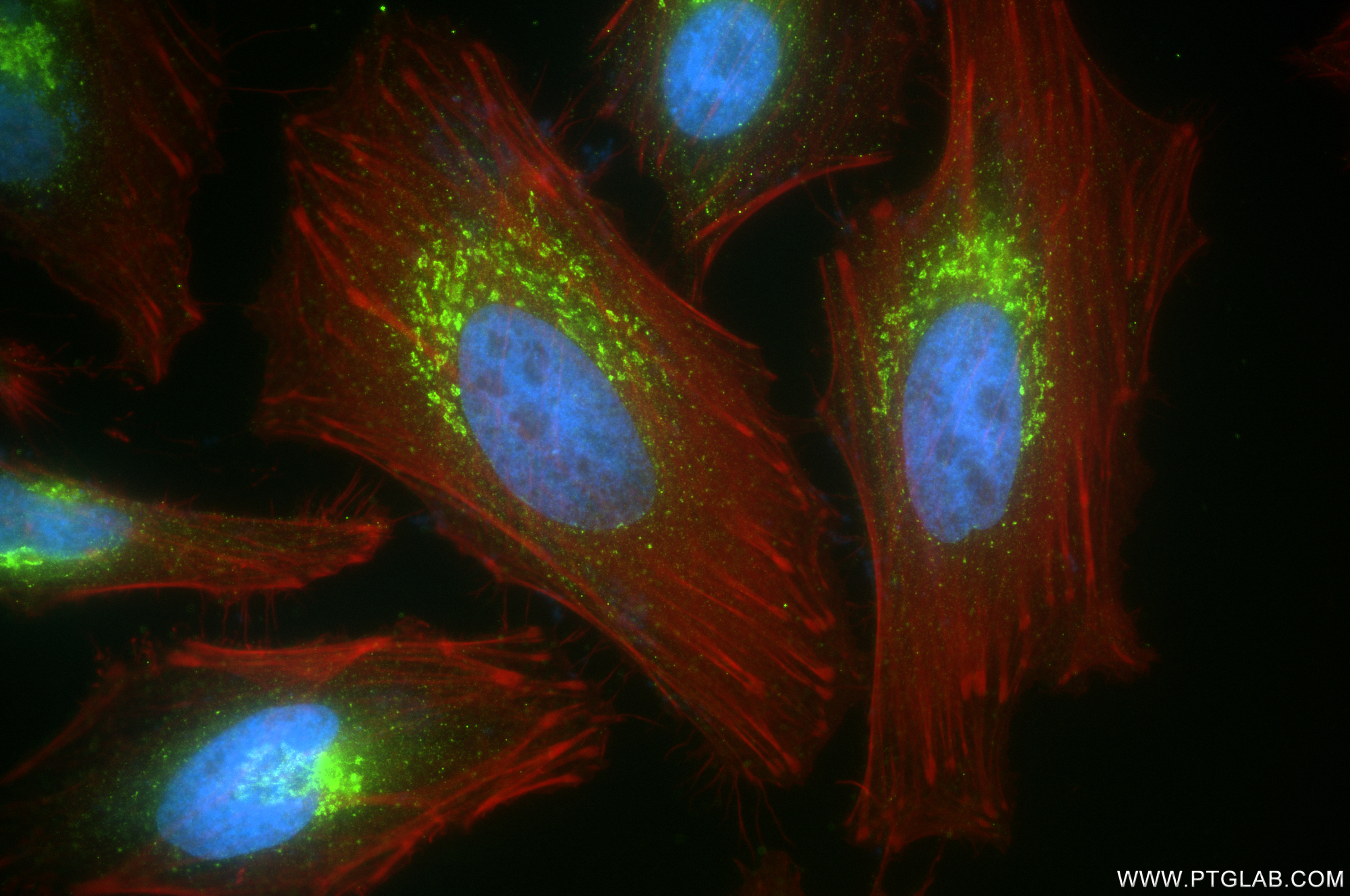 IF Staining of HeLa using 84962-4-RR
