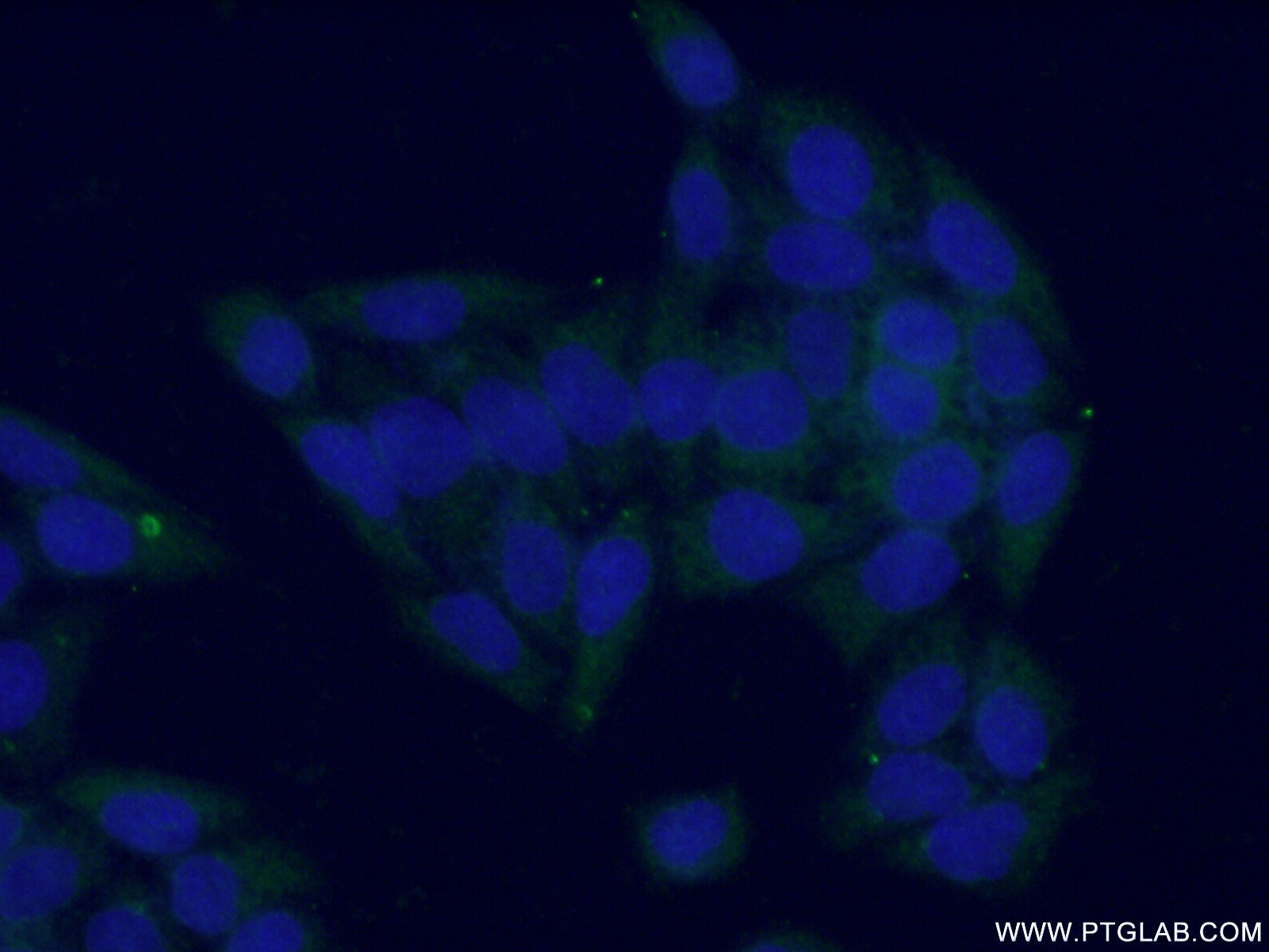 IF Staining of L02 using 14886-1-AP