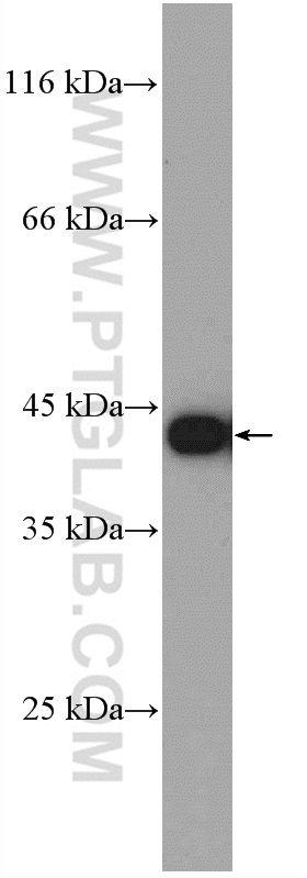 GOT1 Polyclonal antibody