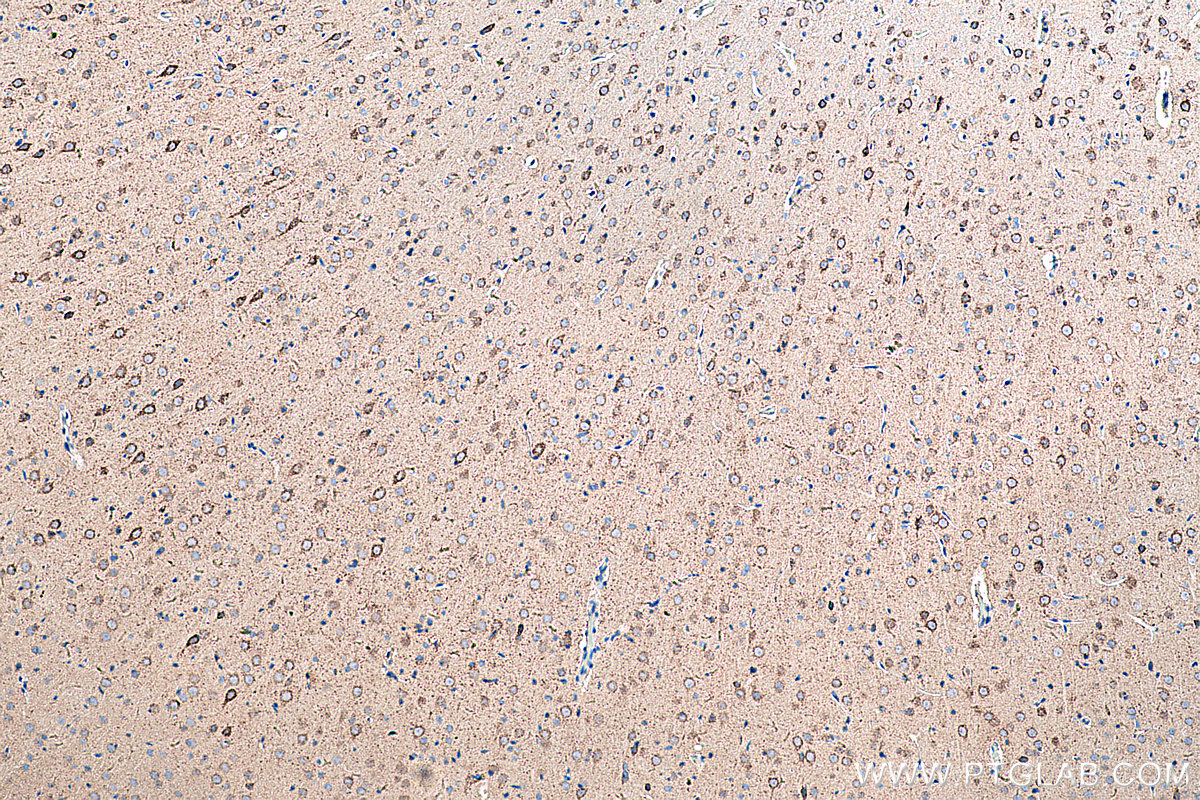 IHC staining of rat brain using 14800-1-AP