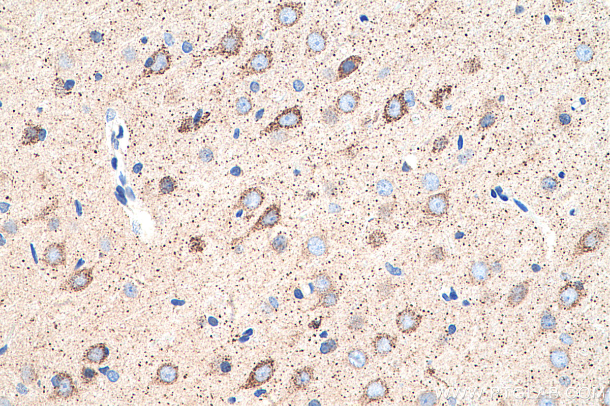 IHC staining of rat brain using 14800-1-AP