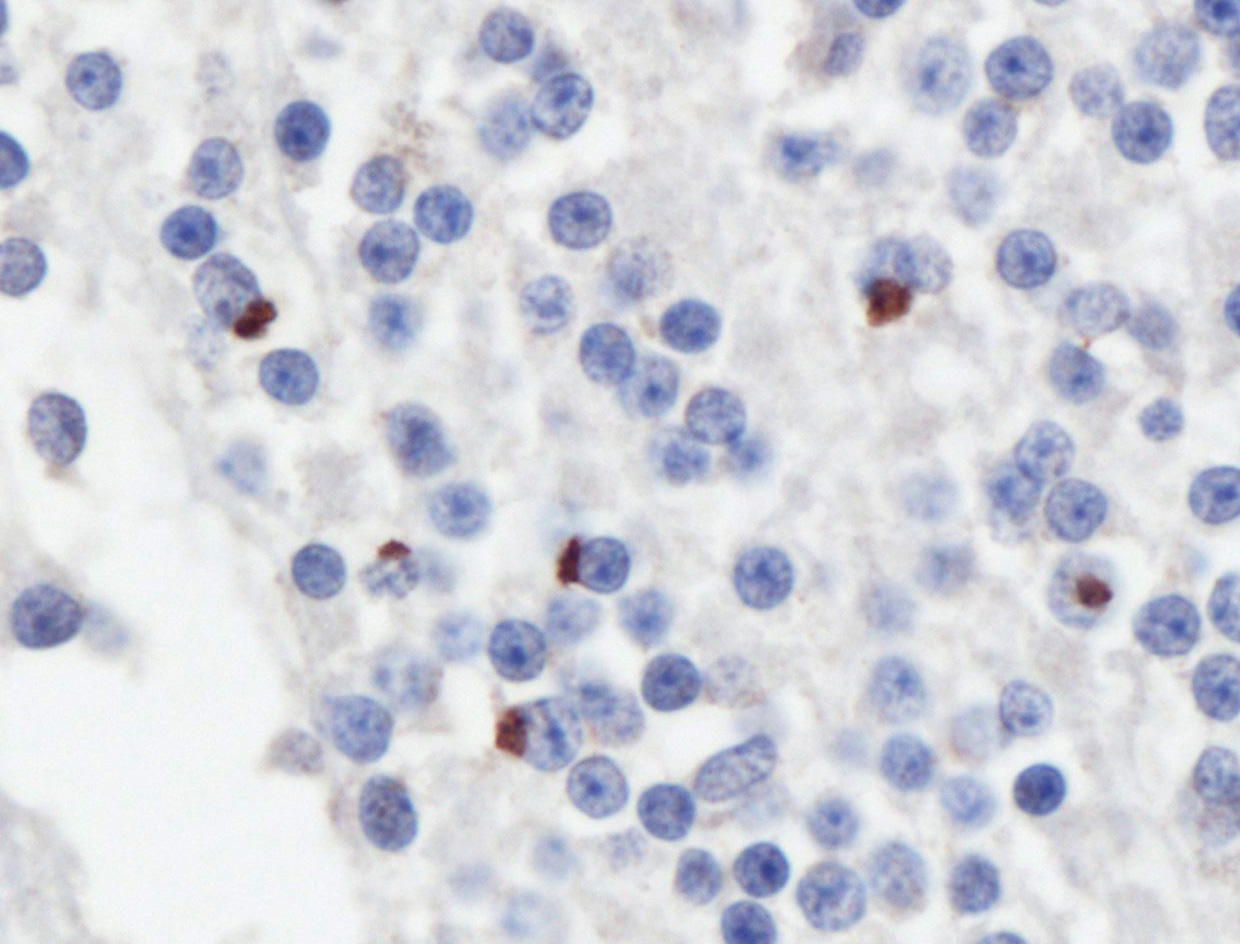 IHC staining of human cerebellum tissue using 24494-1-AP