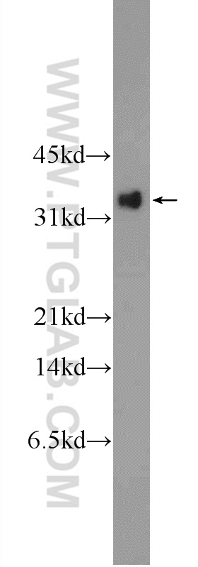 GP repeat Polyclonal antibody
