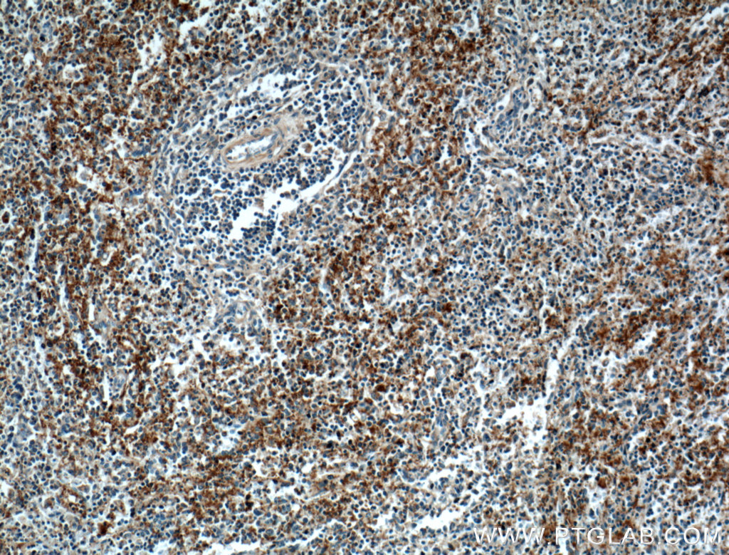 IHC staining of human spleen using 12860-1-AP