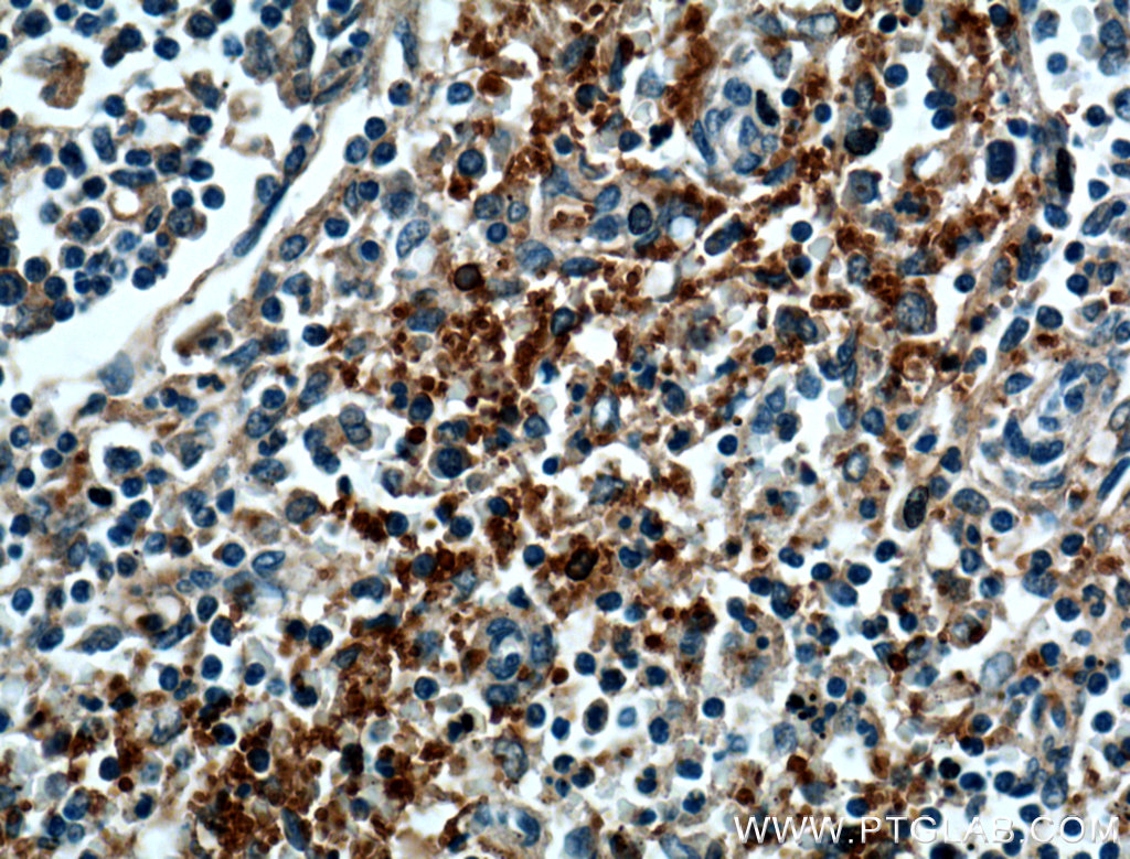 IHC staining of human spleen using 12860-1-AP