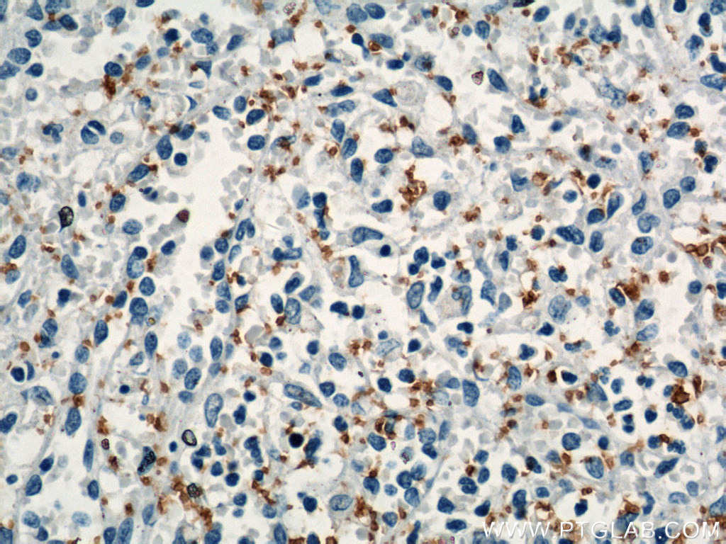 CD42b Polyclonal antibody