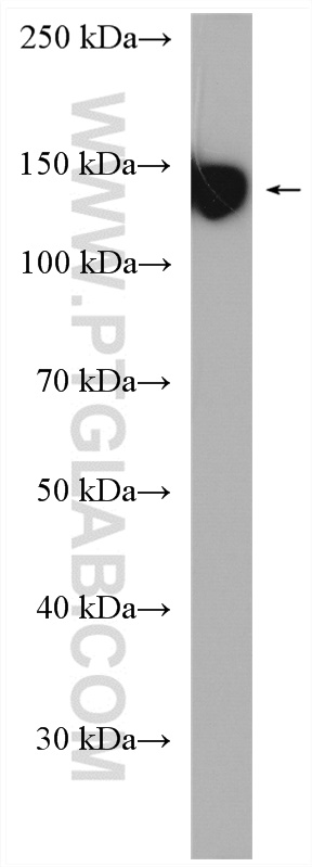 WB analysis of human peripheral blood platelets using 12860-1-AP