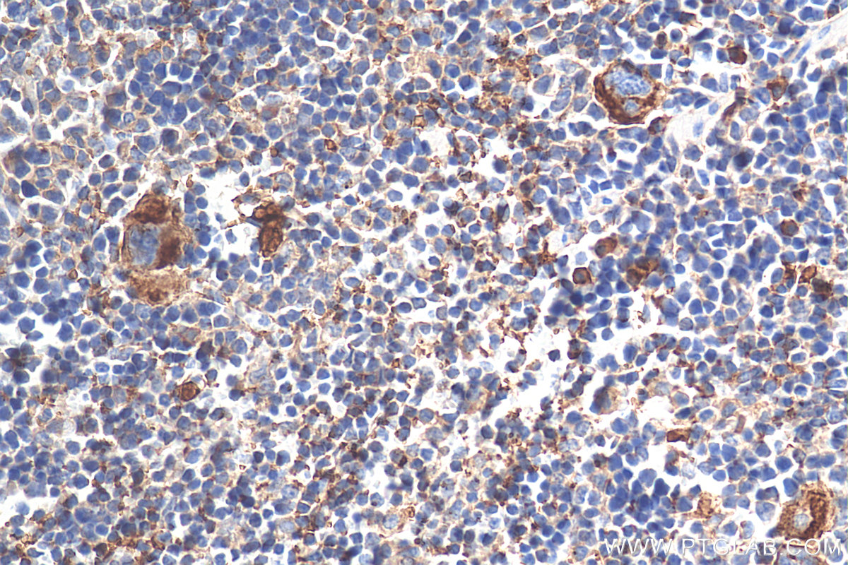 IHC staining of mouse spleen using 67857-1-Ig