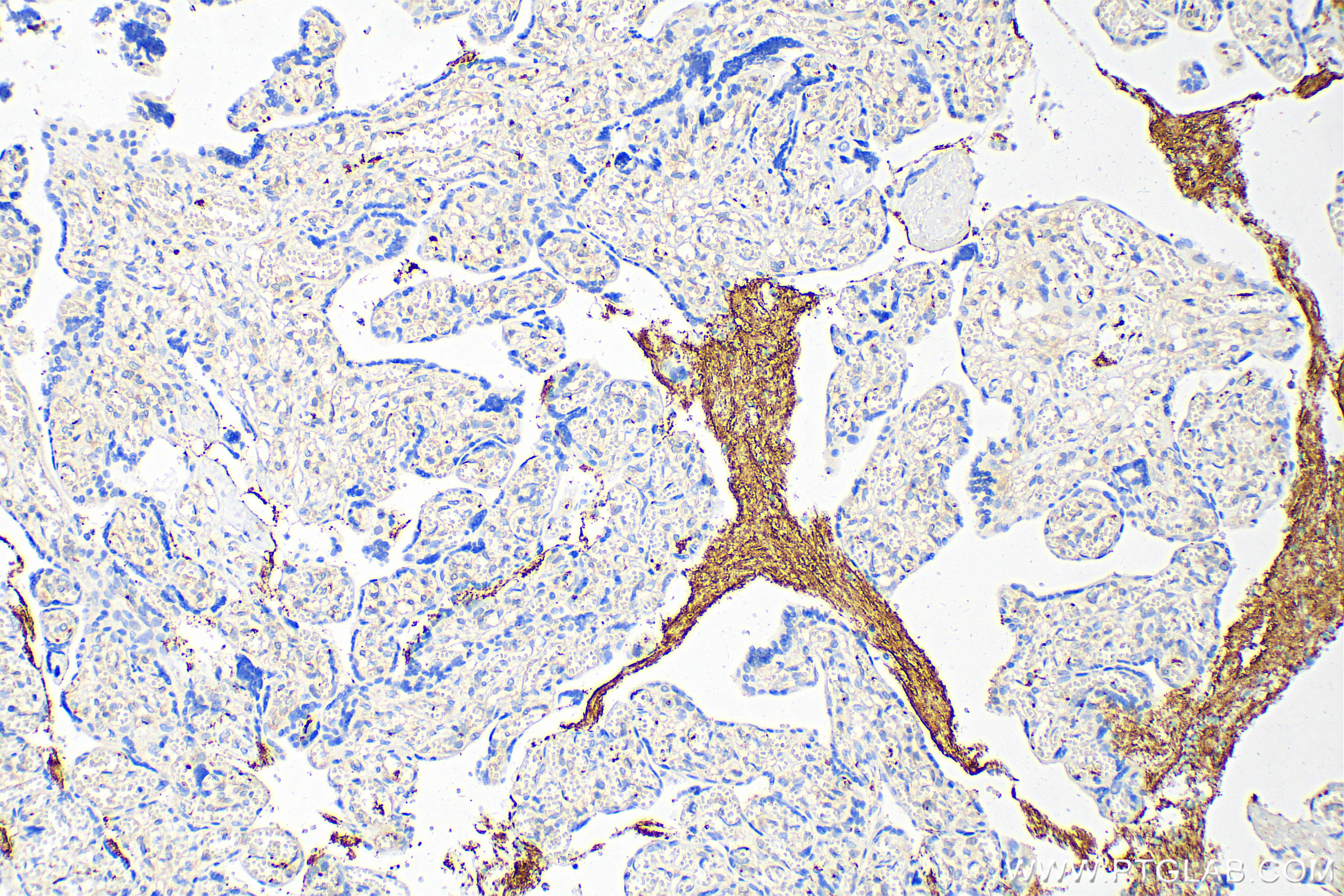 IHC staining of human placenta using 67857-1-Ig