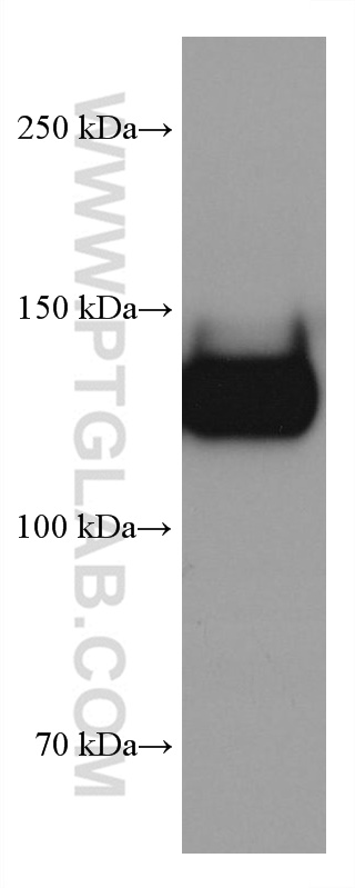 WB analysis of human peripheral blood platelets using 67857-1-Ig