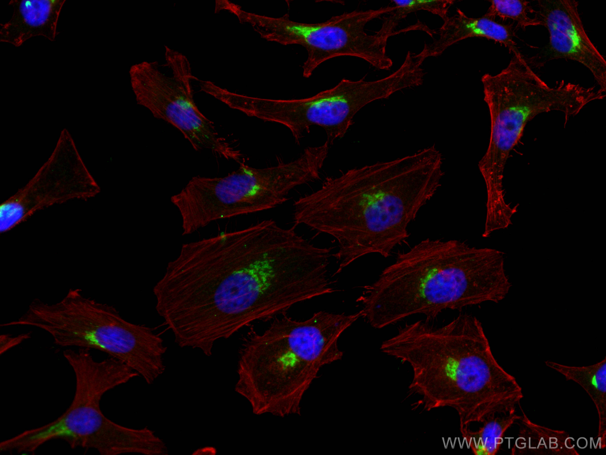 IF Staining of HeLa using 66331-1-Ig (same clone as 66331-1-PBS)