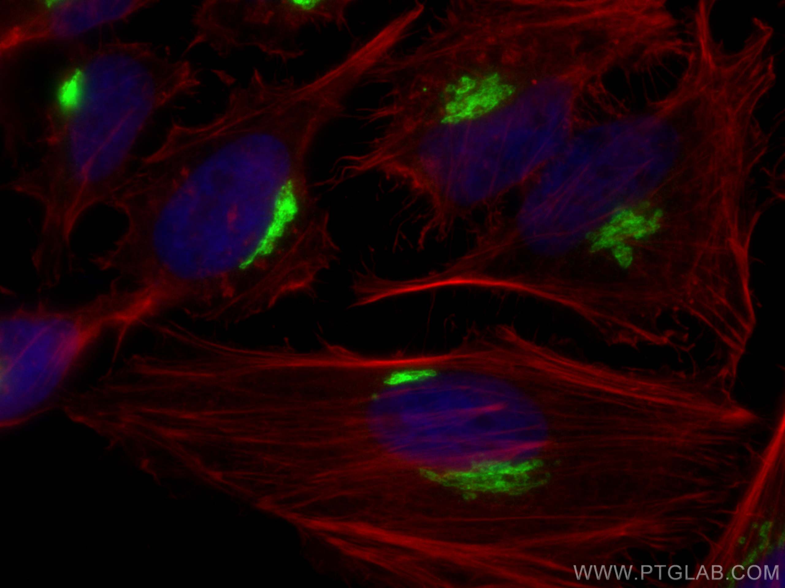 IF Staining of HeLa using 81893-1-RR