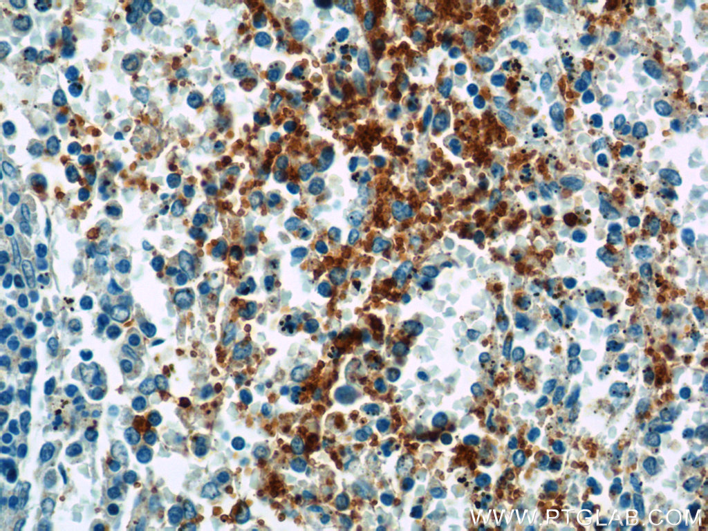 IHC staining of human spleen using 14564-1-AP