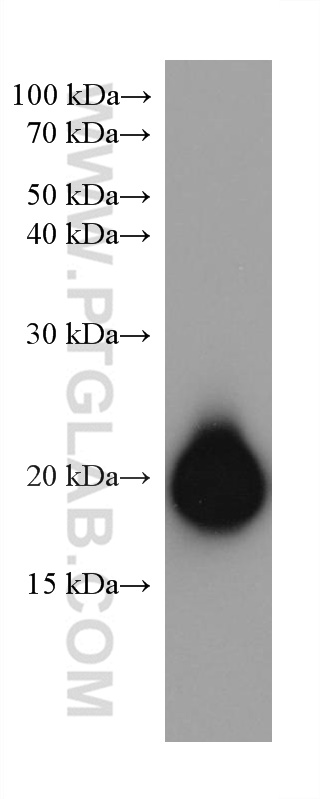 WB analysis of human peripheral blood platelets using 67271-1-Ig