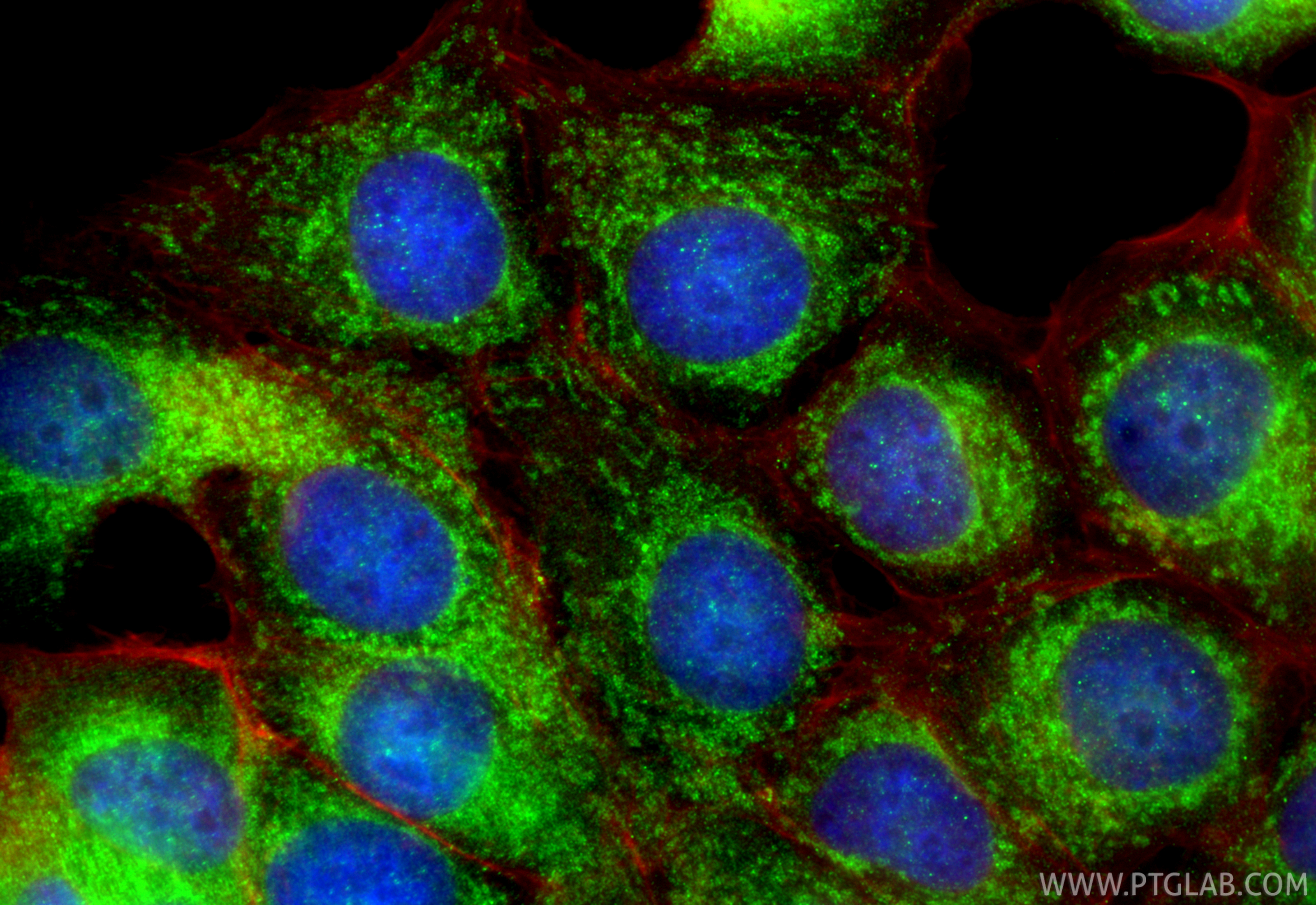 Immunofluorescent analysis of (4% PFA) fixed MCF-7 cells using GPAM antibody (12454-1-AP) at dilution of 1:400 and CoraLite®488-Conjugated Goat Anti-Rabbit IgG(H+L) (<a class='green' href='/productredirect?CatalogNo=SA00013-2' target='_blank'>SA00013-2</a>), CL594-Phalloidin (red). IF Staining of MCF-7 using 12454-1-AP