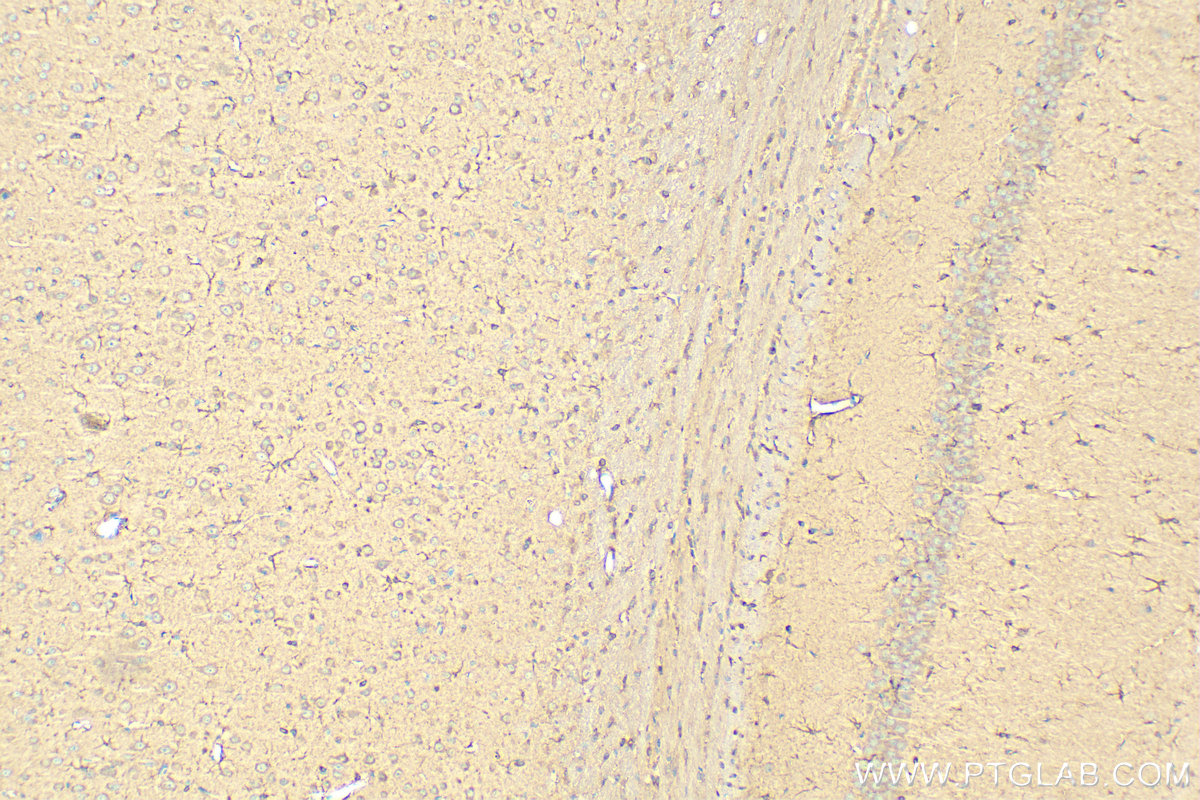 IHC staining of rat brain using 12454-1-AP