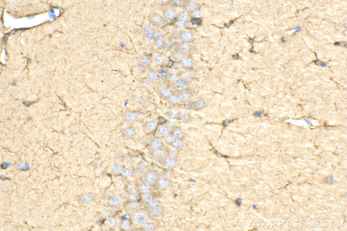 IHC staining of rat brain using 12454-1-AP