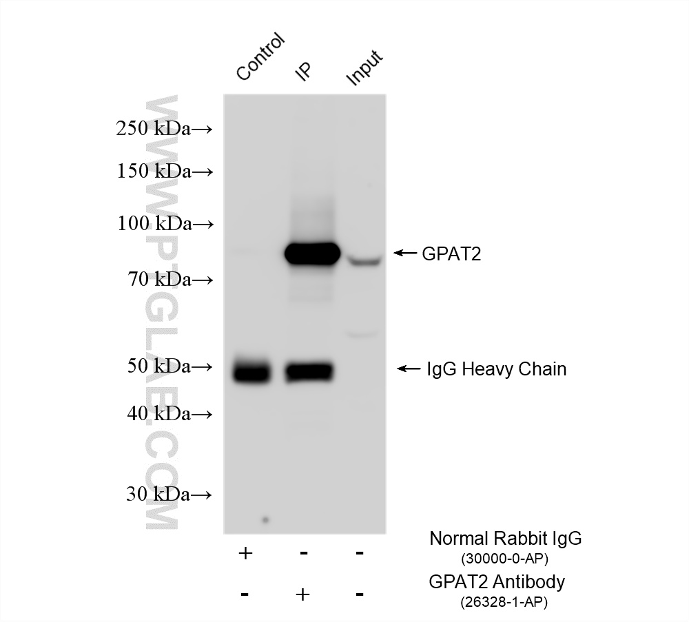 IP experiment of rat testis using 26328-1-AP IP experiment of rat testis using 26328-1-AP