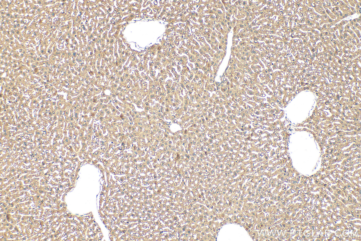 IHC staining of mouse liver using 30765-1-AP