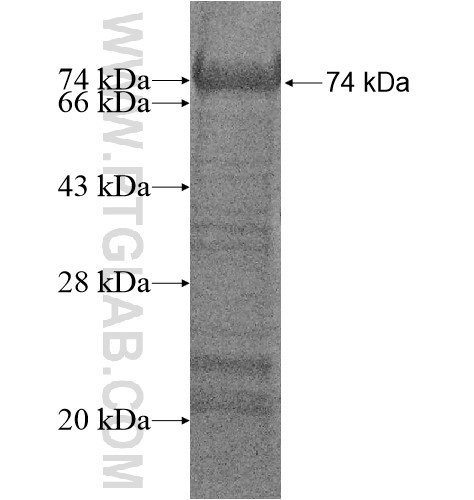 GPATCH1 fusion protein Ag14612 SDS-PAGE GPATCH1 fusion protein Ag14612 SDS-PAGE
