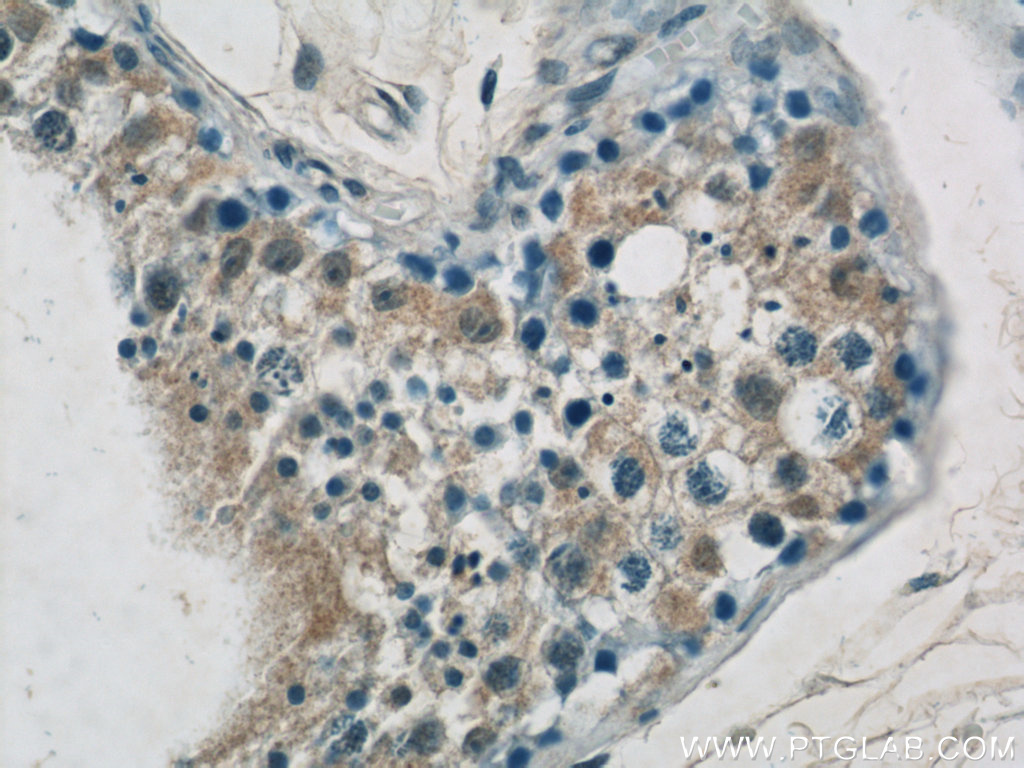 IHC staining of human testis using 24366-1-AP