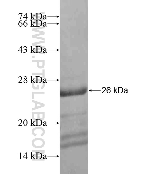 GPATCH4 fusion protein Ag20285 SDS-PAGE GPATCH4 fusion protein Ag20285 SDS-PAGE