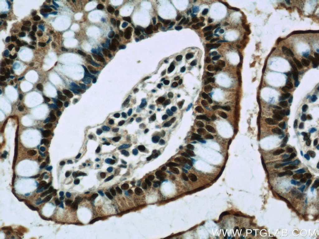 IHC staining of human small intestine using 21622-1-AP