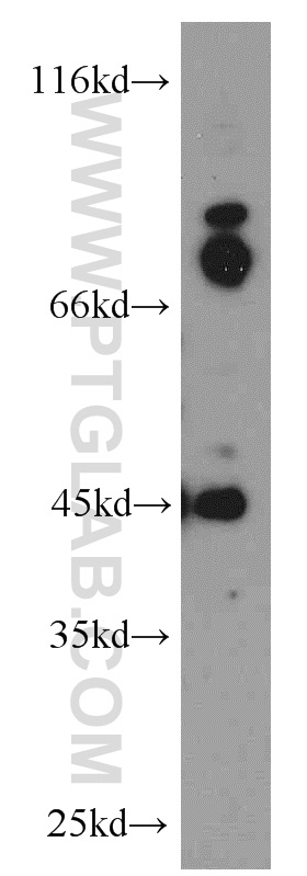 WB analysis of HepG2 using 21622-1-AP