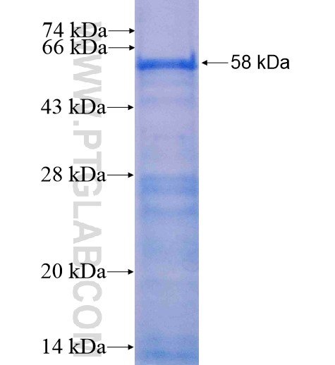 GPBP1L1 fusion protein Ag11316 SDS-PAGE GPBP1L1 fusion protein Ag11316 SDS-PAGE