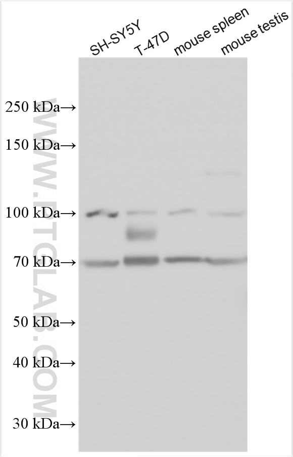 WB analysis using 13521-1-AP