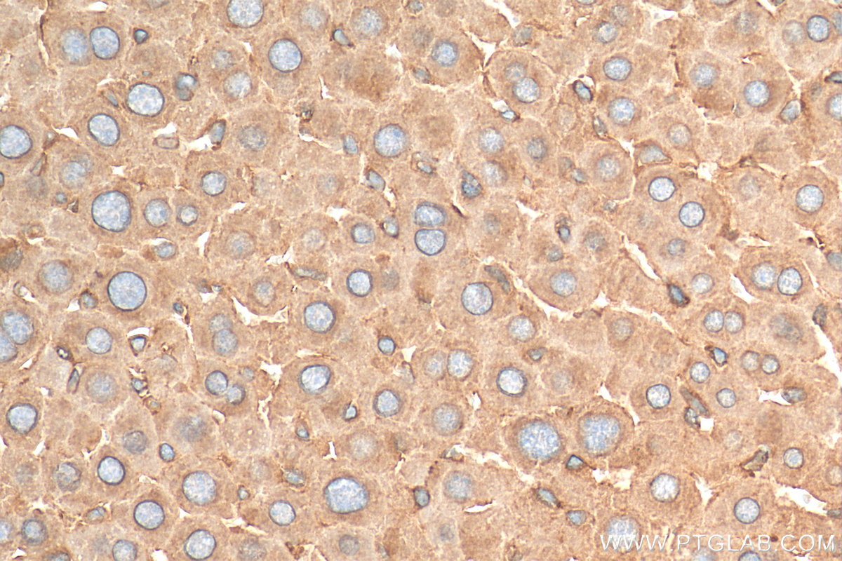 IHC staining of mouse liver using 30021-1-AP