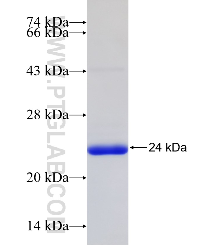 GPC3 fusion protein Ag32573 SDS-PAGE GPC3 fusion protein Ag32573 SDS-PAGE