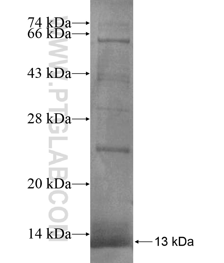 GPC6 fusion protein Ag17369 SDS-PAGE GPC6 fusion protein Ag17369 SDS-PAGE