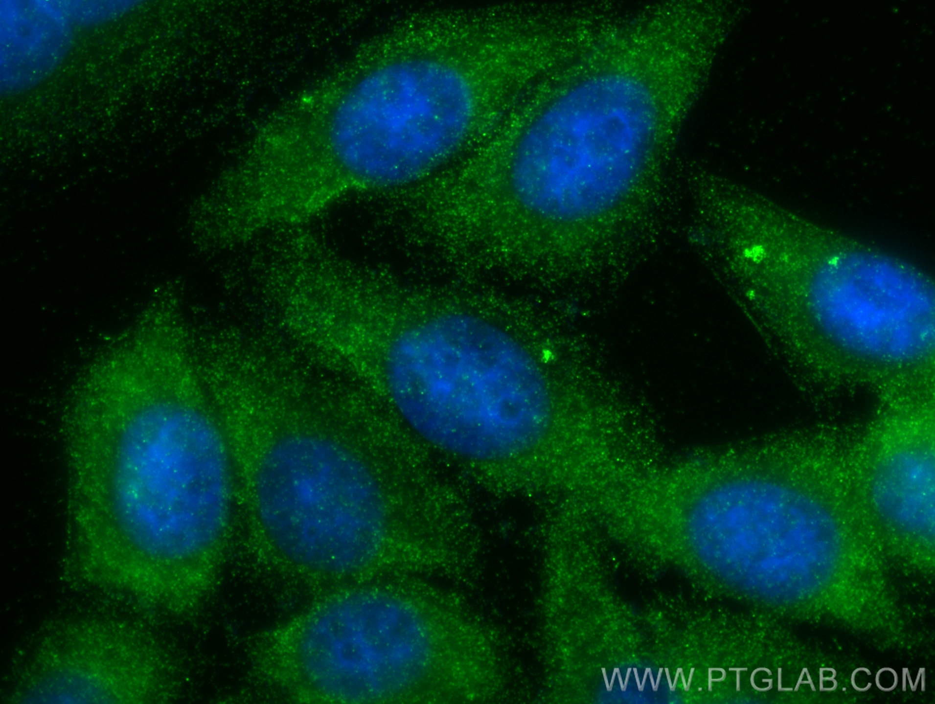 IF Staining of HepG2 using 13451-1-AP (same clone as 13451-1-PBS)