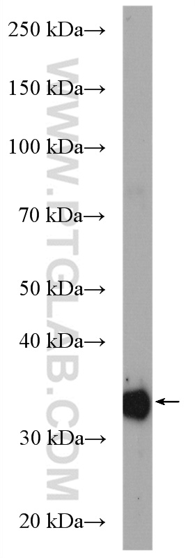 WB analysis of rat liver using 27943-1-AP (same clone as 27943-1-PBS)