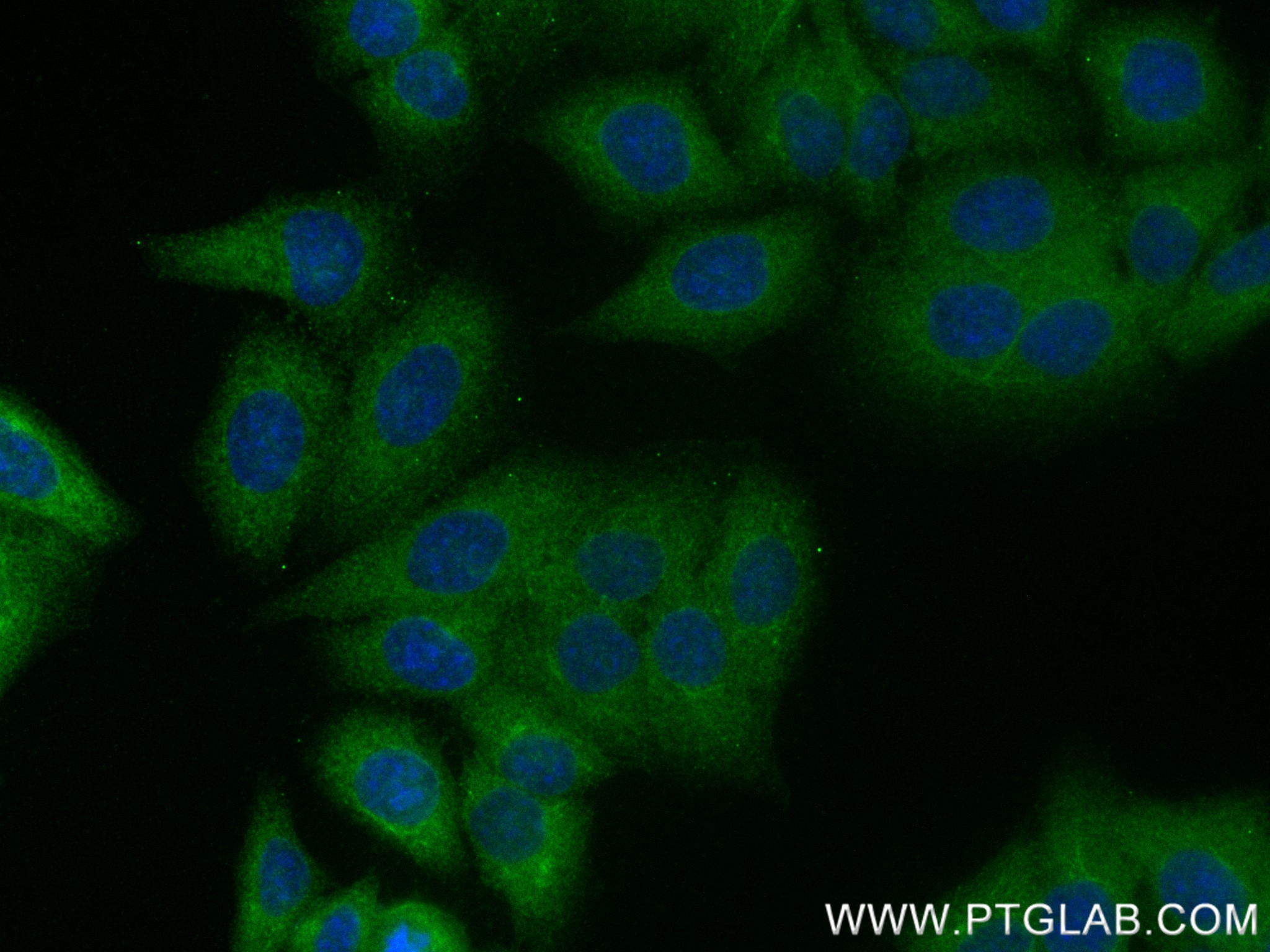 IF Staining of HepG2 using 84800-1-RR