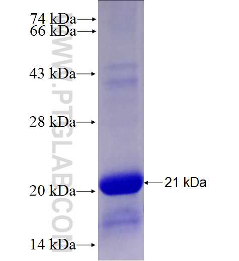 GPD1 fusion protein Ag27710 SDS-PAGE GPD1 fusion protein Ag27710 SDS-PAGE