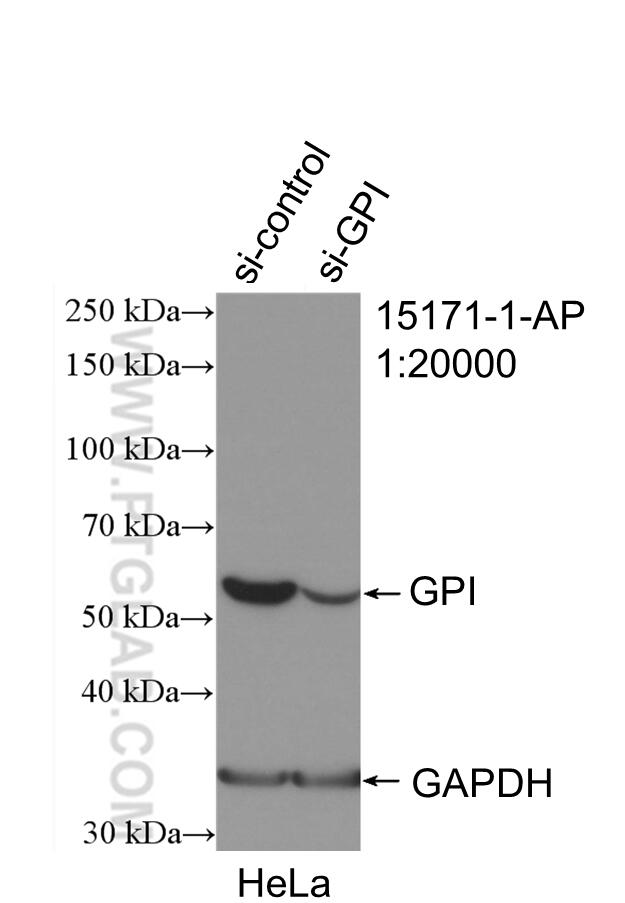 WB analysis of HeLa using 15171-1-AP