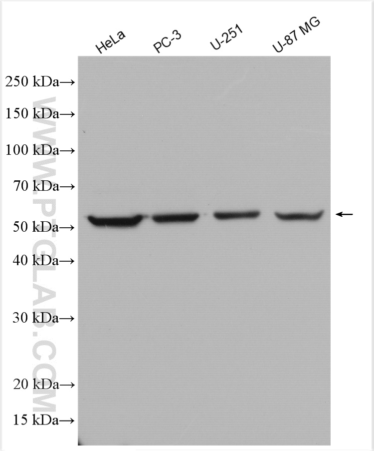 WB analysis using 15171-1-AP