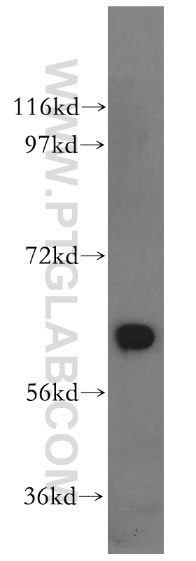 GPI Polyclonal antibody
