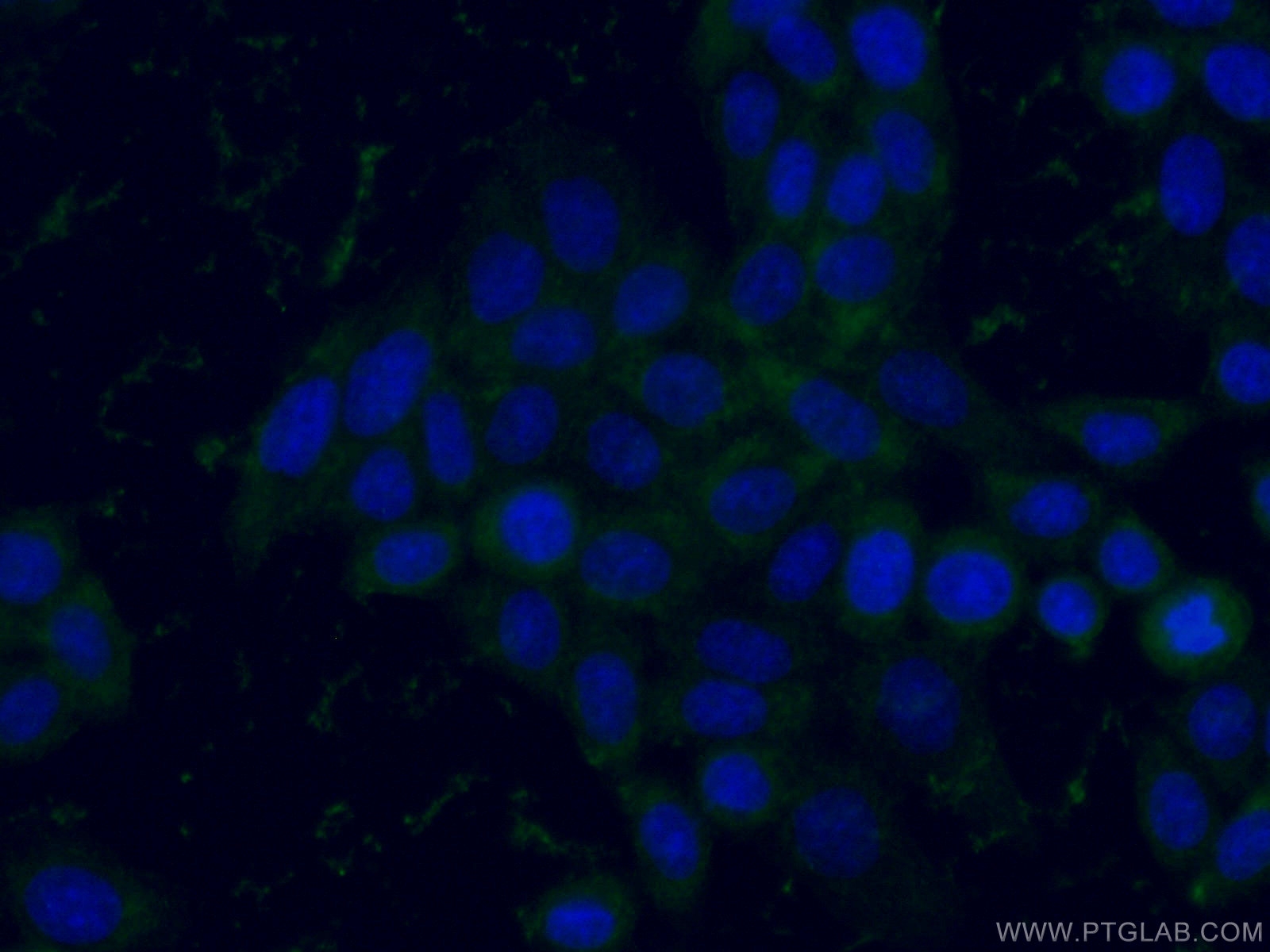 IF Staining of PC-3 using 67178-1-Ig